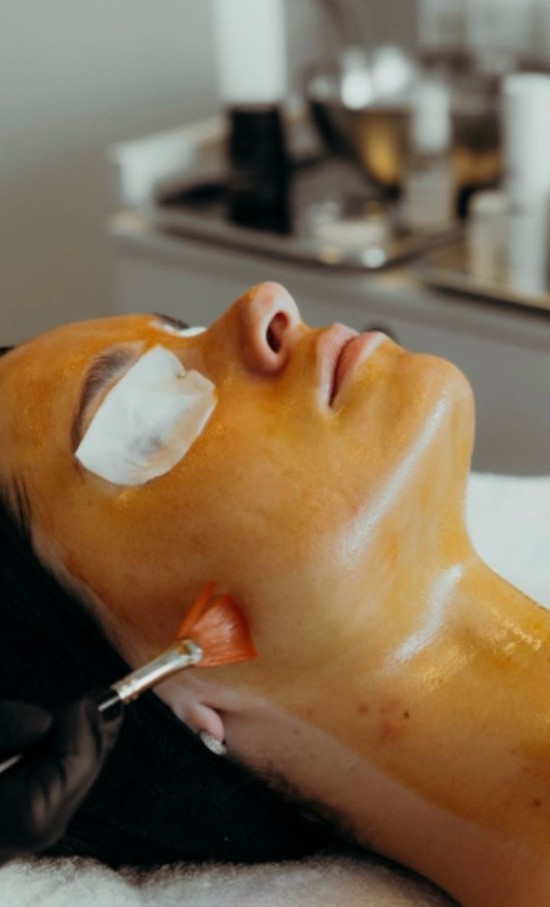Chemical Peel