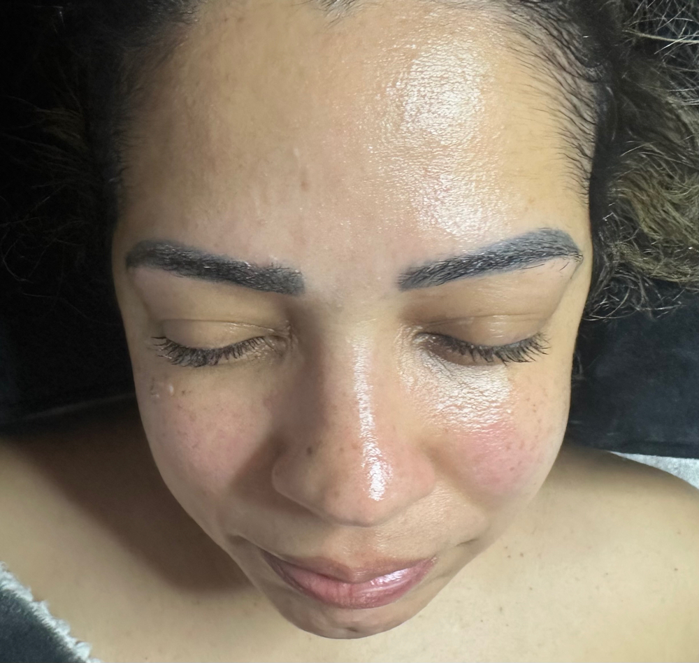 Dermaplane Facial at Bellissima Skin & Beauty in Madison, WI