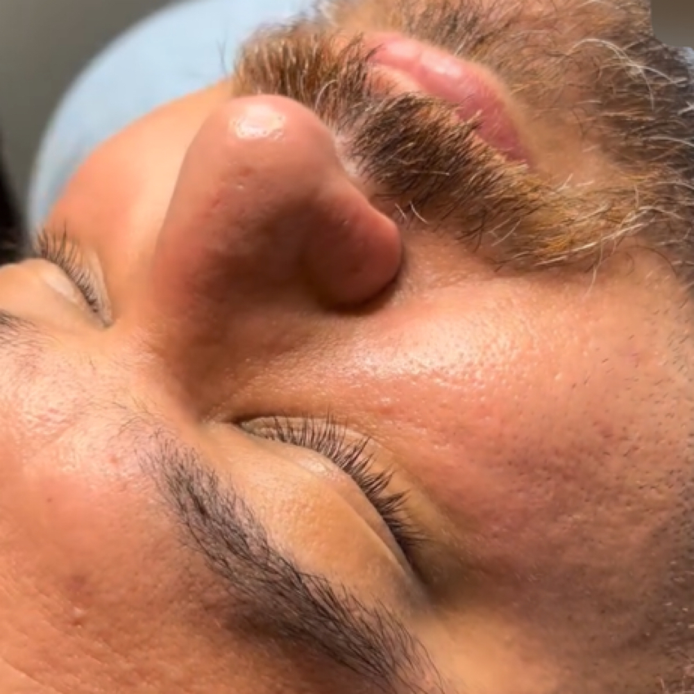 Male Micro Need | Chem Peel at Merkaba Maintenance in Orange Park, FL