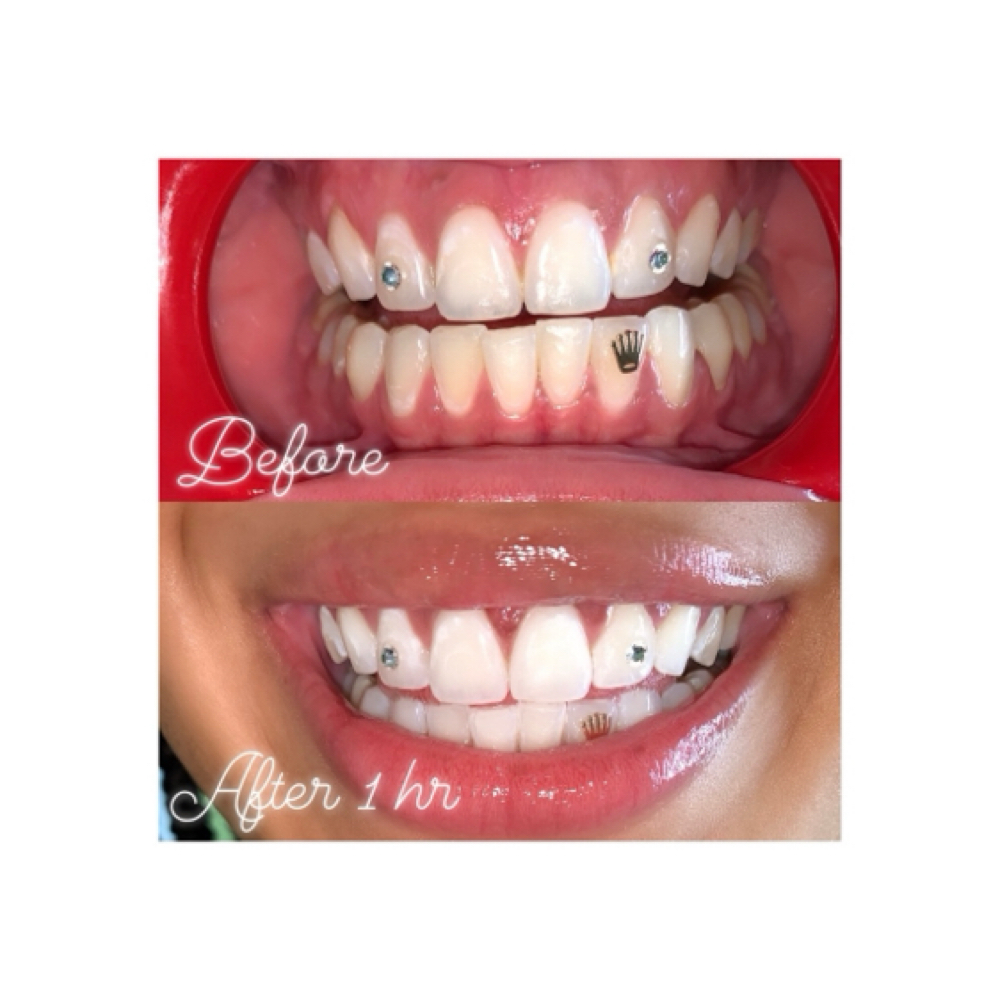 ROLEX ♛ TIARAᴺᴶ at MONMOUTH COUNTYᴺᴶ ✧ 1ST TOOTH JEWELER ↯ #POPURWAXINCHERRY in Hazlet, NJ