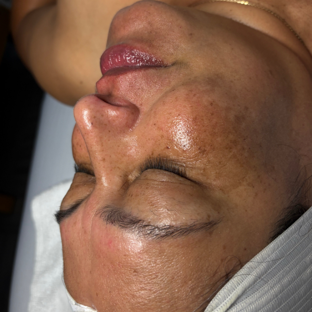 Bare Essentials Facial at Ikonic Aesthetic Lounge in Asheboro, NC