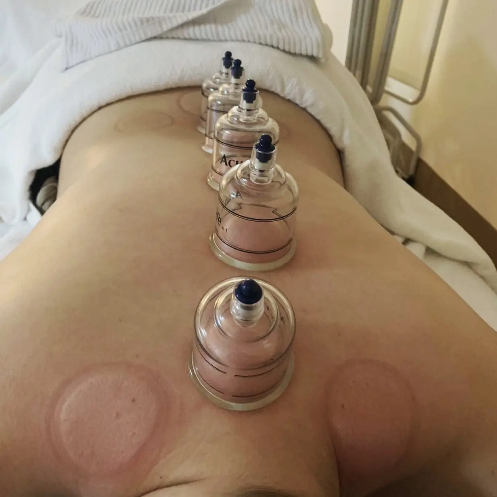 Back Facial w/ Body Cupping