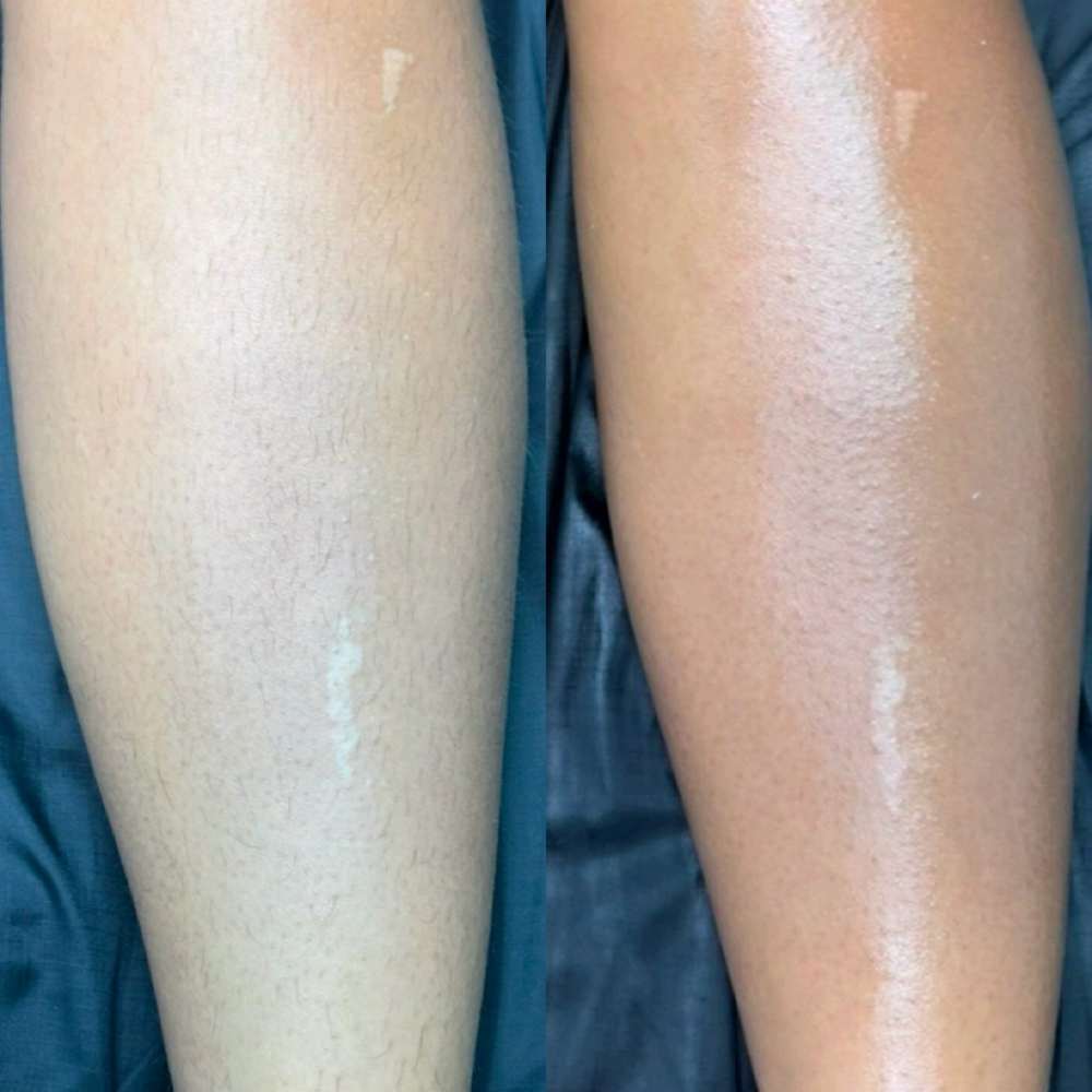 Full Legs Wax at Endlessbeauty in Ceres, CA