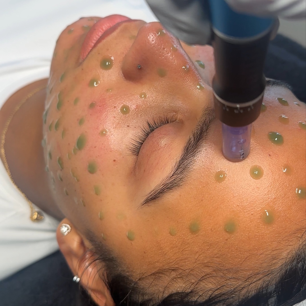 Advanced Healing Therapy at Skin & Soul in Brooklyn, NY