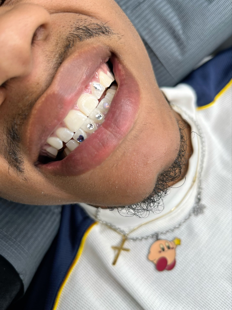 Tooth Gems (4)