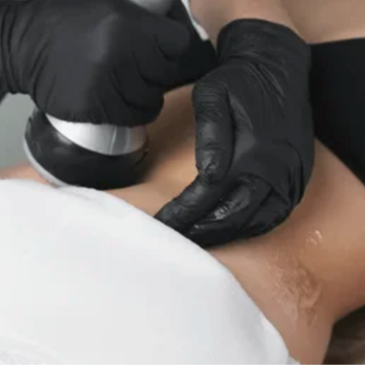 ULTRASOUND/RF TREATMENT at Aurora Rose Beauty Spa in Fayetteville, NC