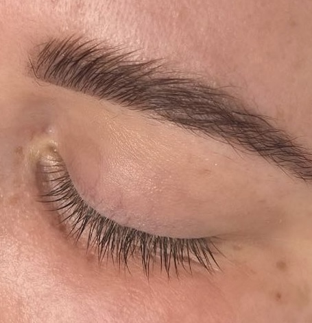 Lash Removal