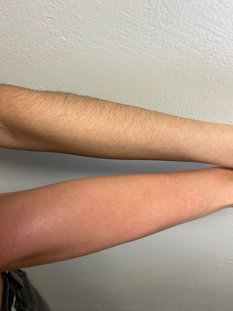 Arm Wax