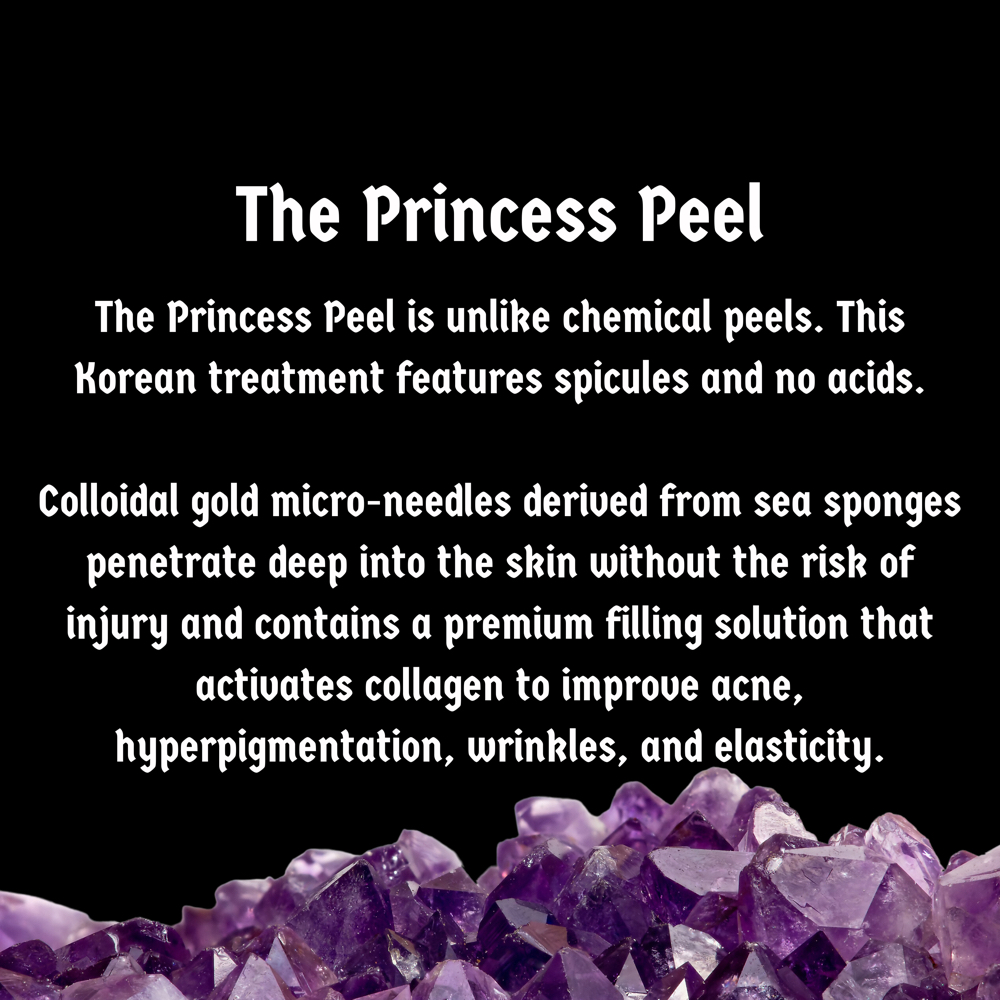 The Princess Peel®
