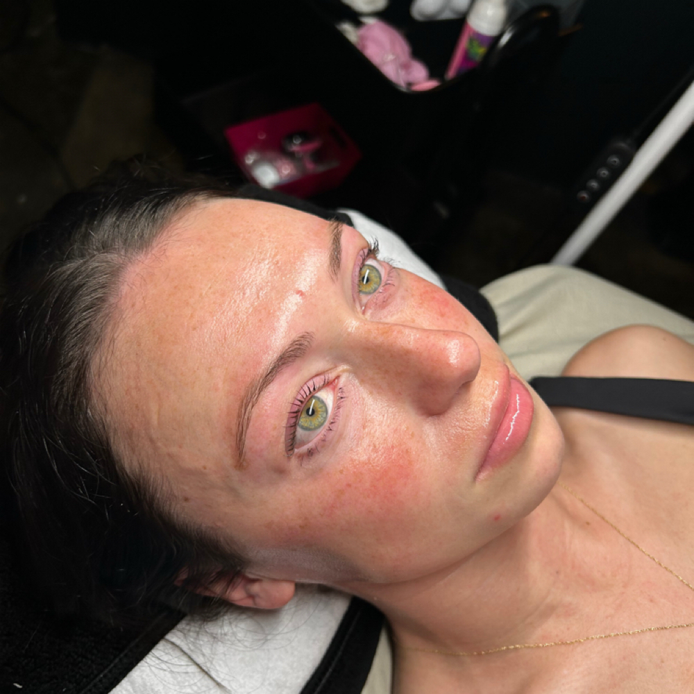 Dermaplane Facial at Abi Aesthetics in Princeton, KY