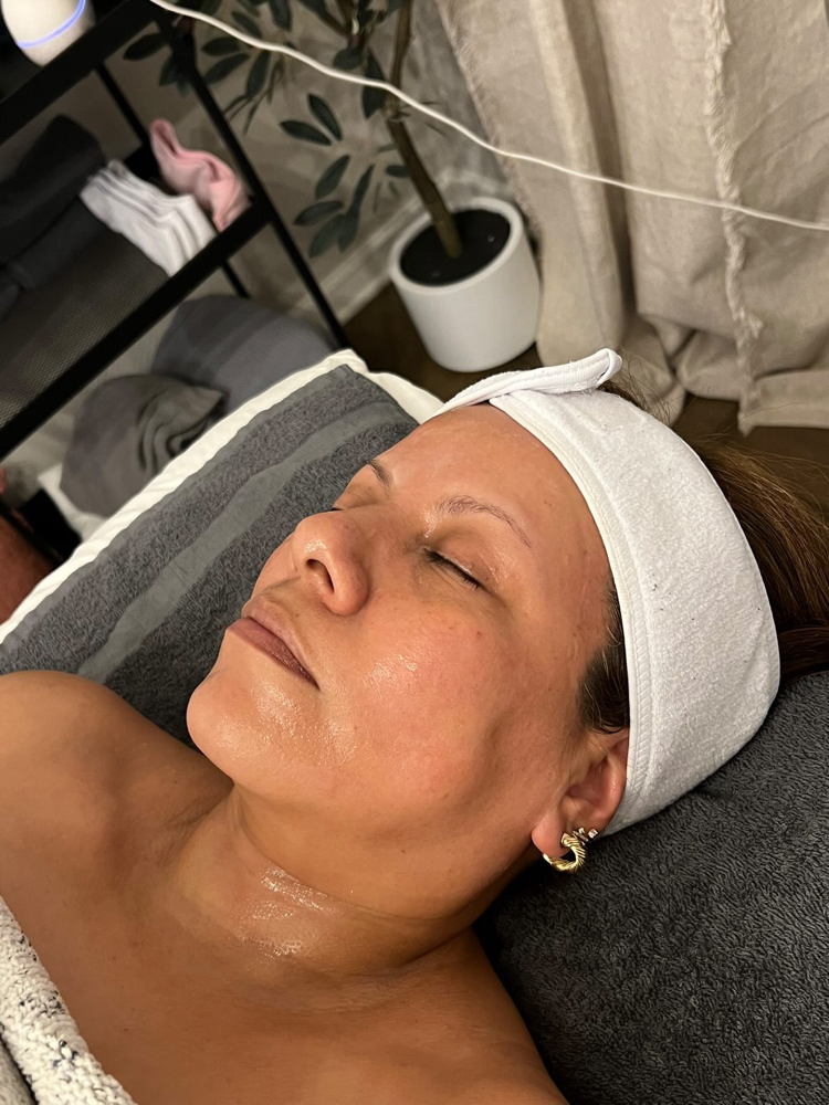 Dermaplane & Chemical Peel Combo at Mirada Esthetics in Franklin, TN