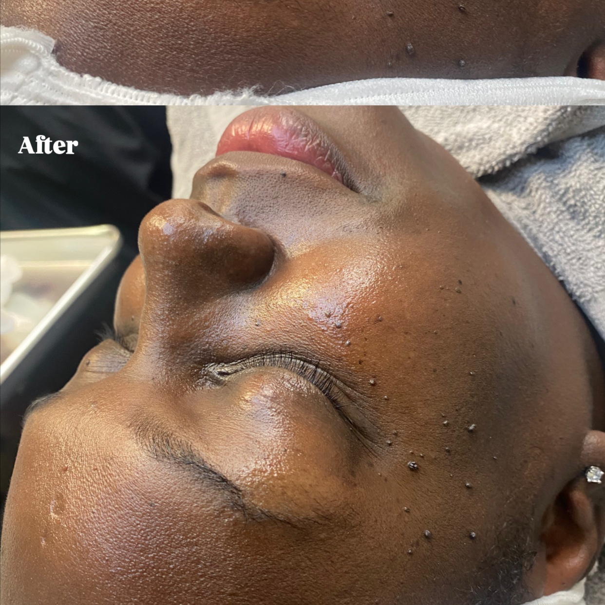 Microdermabrasion Facial at Crown Of Essence Hair Studio in COLUMBUS, GA