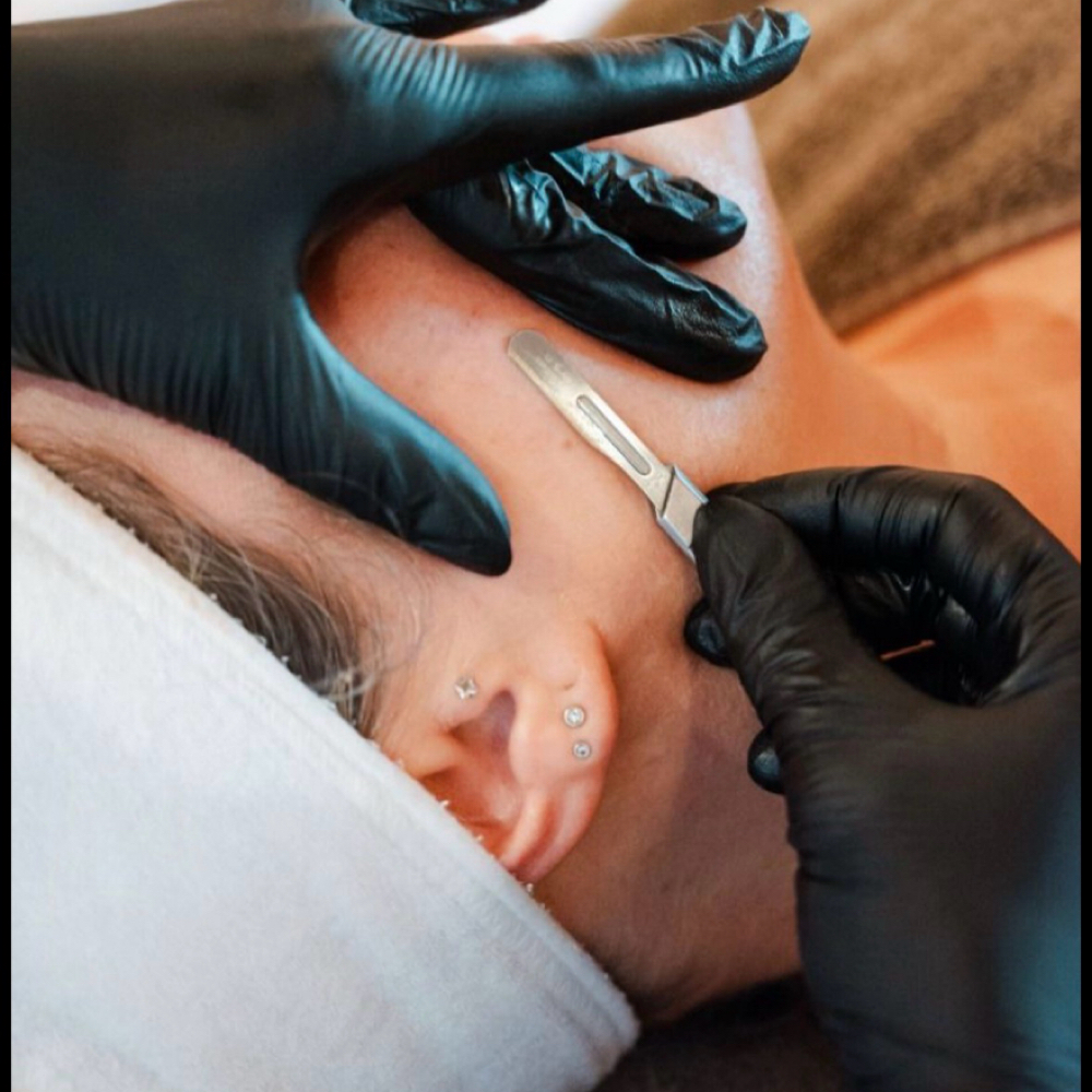 Dermaplaning Facial at Beloved Beauty Aesthetics in Bonne Terre, MO