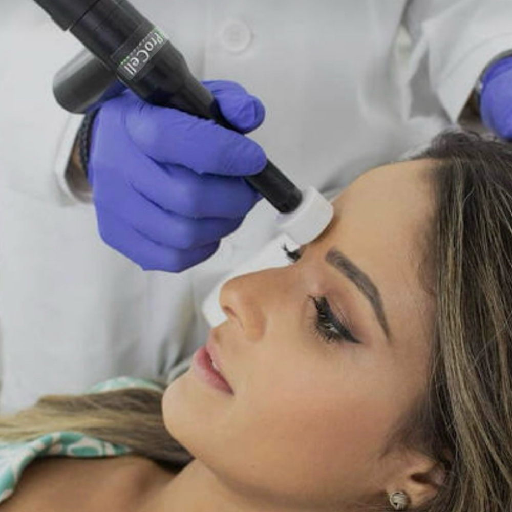 Procell MD Microchanneling at “Illuminate” Skin By Mariah in St. Louis Park, MN