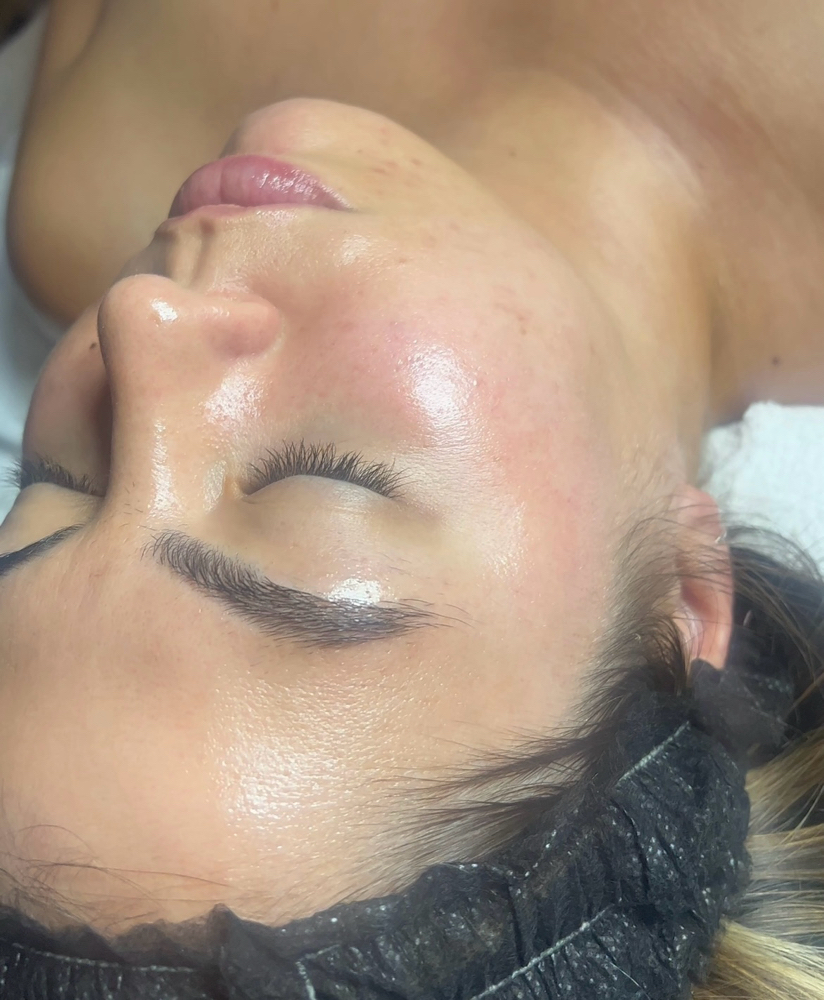 Classic Dermaplane
