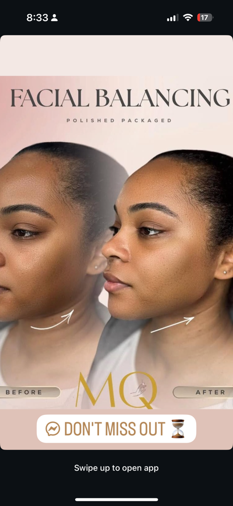 1 Syringe Of Facial Filler at Magnetic Aesthetics in Frisco, TX