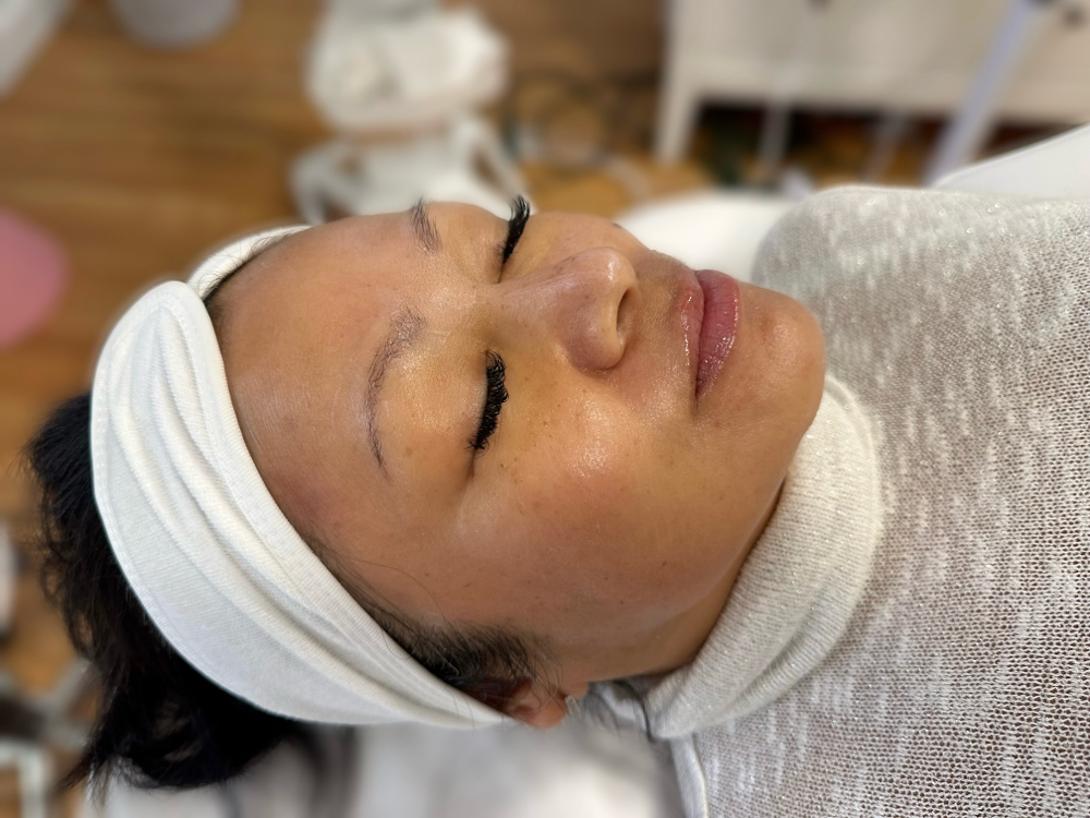 Facial Dermaplane
