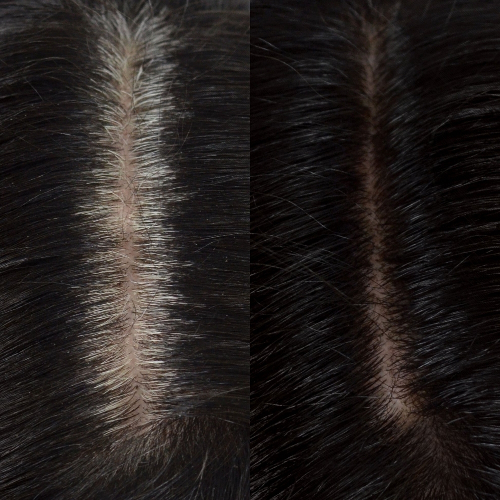 Root Retouch