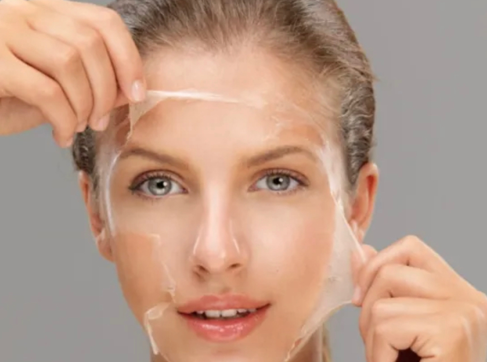 Chemical Peel