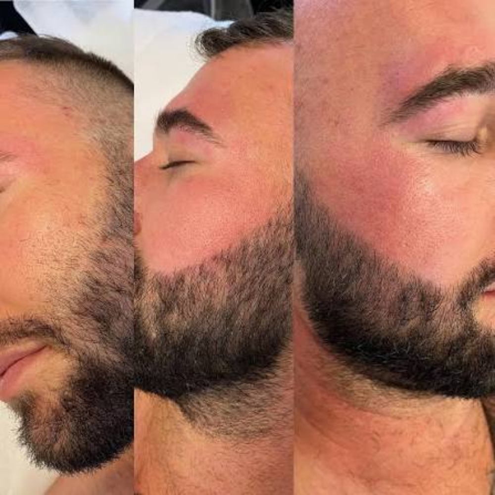 Waxing Top of Mens Beard at 121 Studio in Marshall, IL