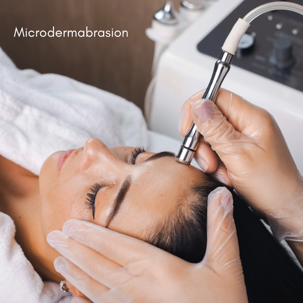 Microdermabrasion Treatment