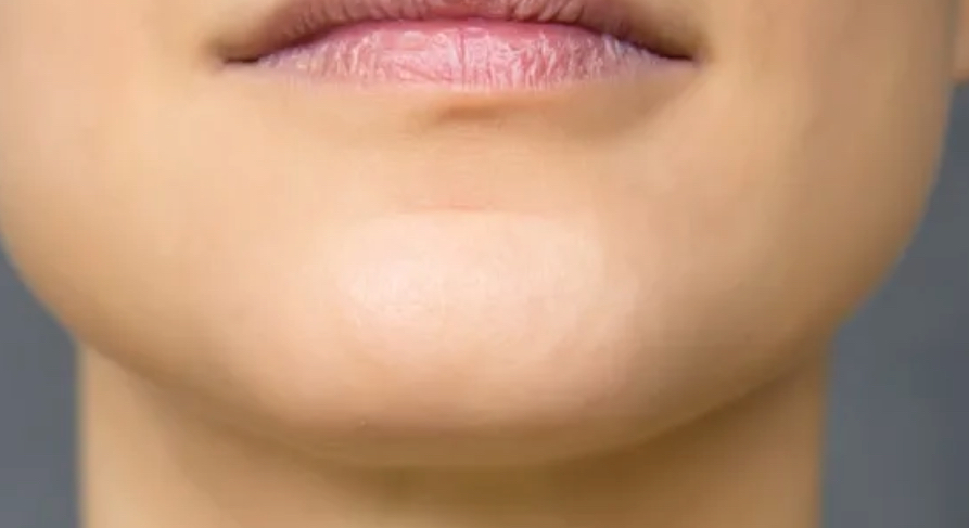 Chin