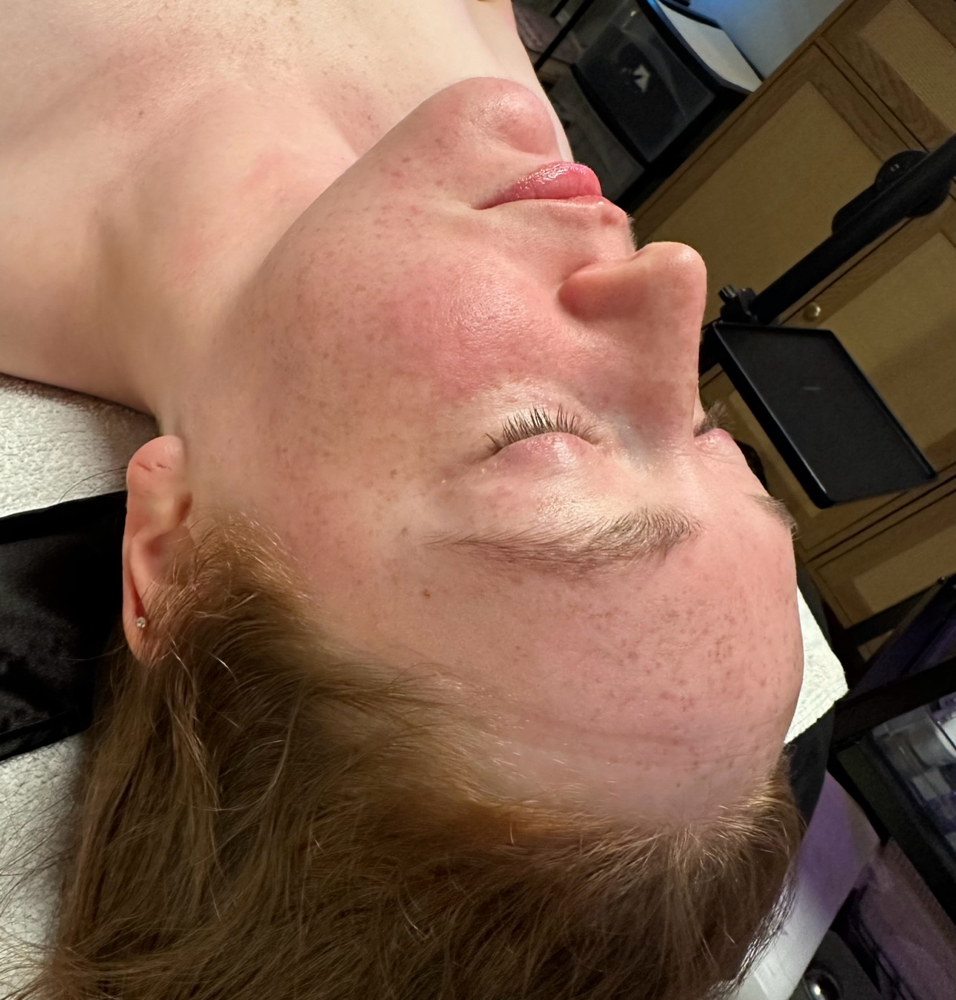 Custom Enzyme Facial