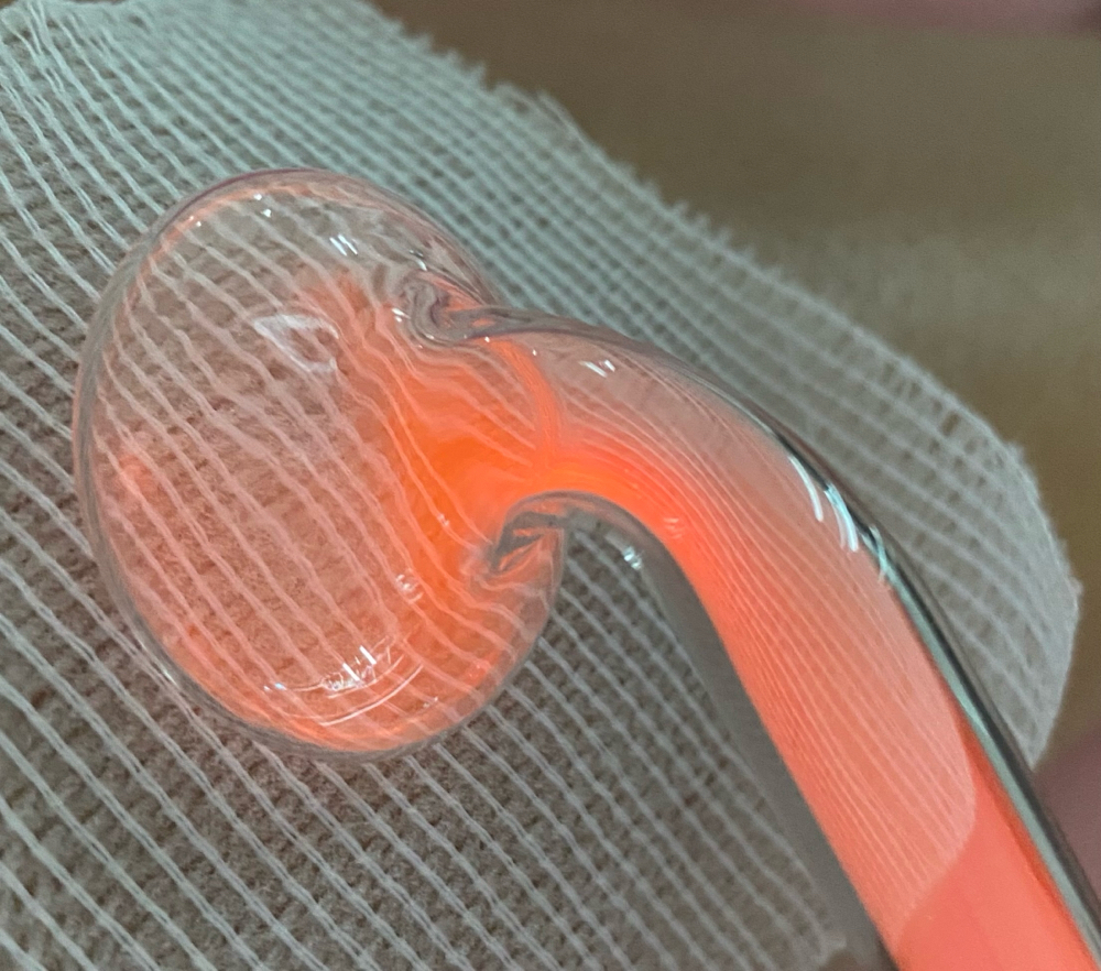 High Frequency Treatment