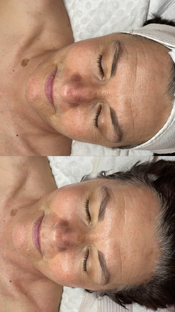 Full face Alkaline Wash