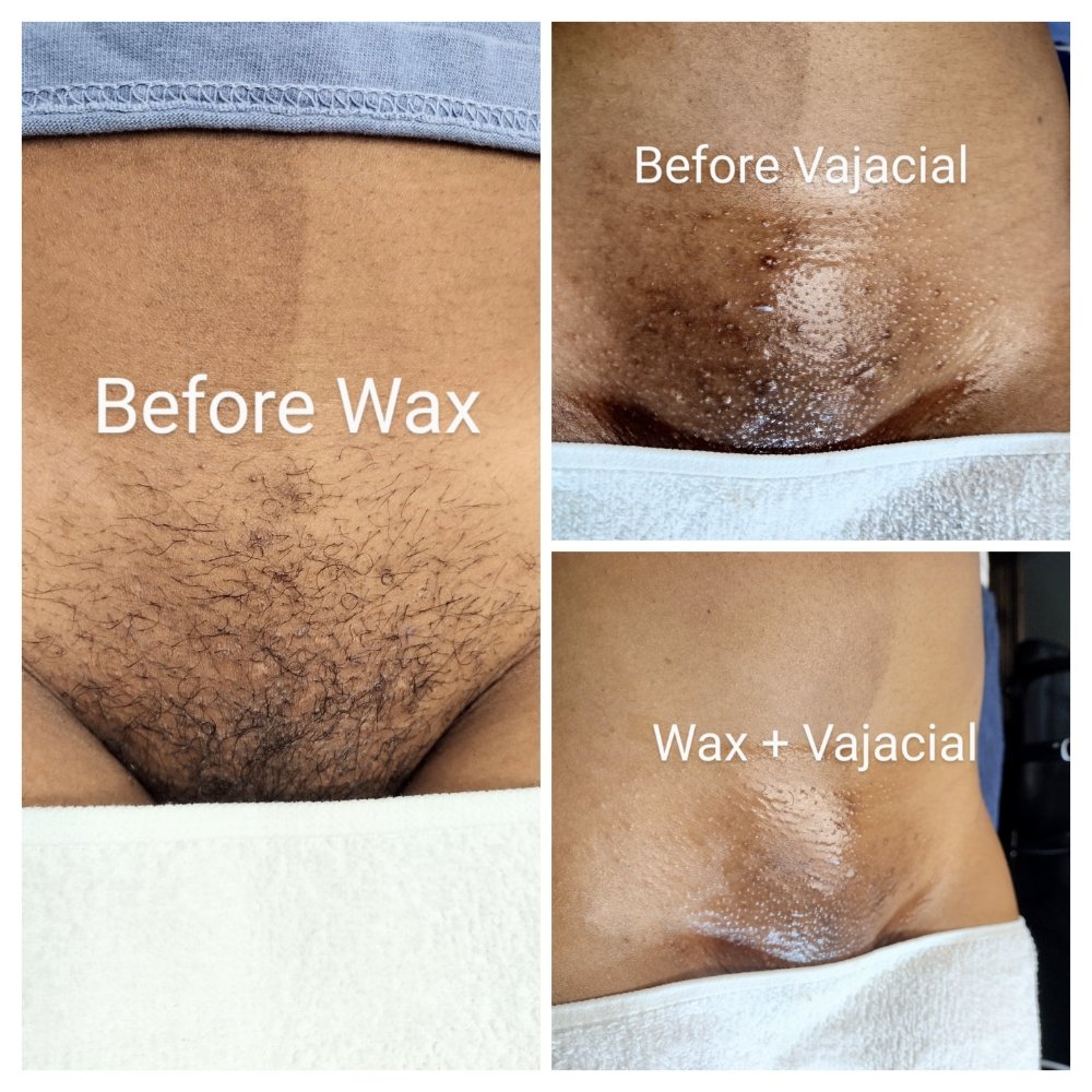 Brazillian Wax With Vajacial