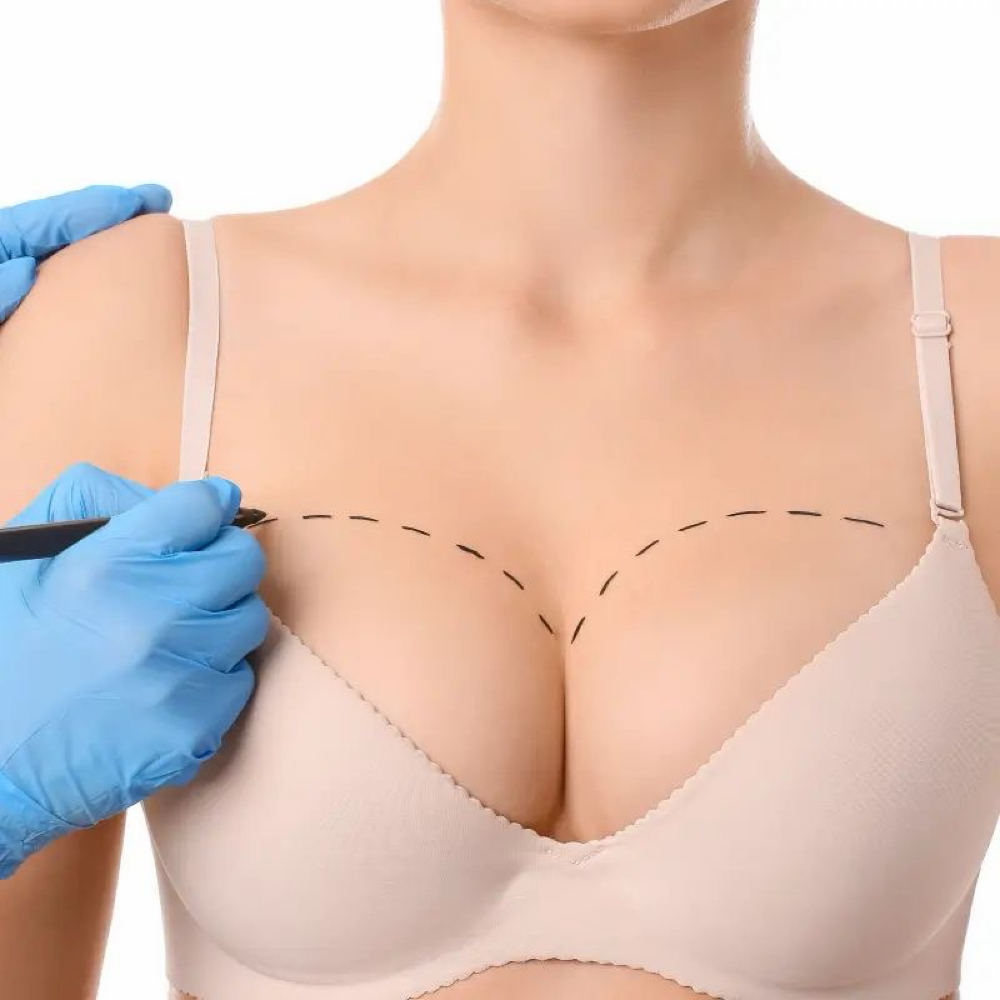 Non Invasive Breast Lift at Opulent Lash & Beauty in Cabot, AR