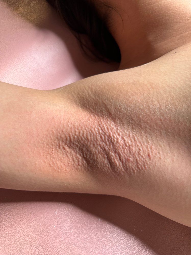 Underarm wax