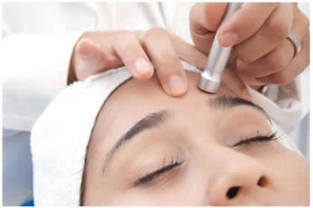 Microdermabrasion