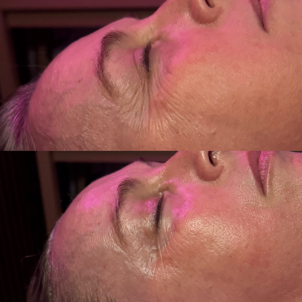 “QUEEN’s FACE THERAPY” | 90 min |