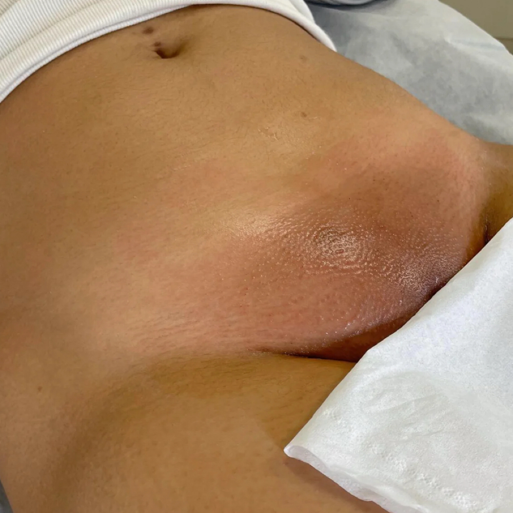 🎰Bikini Waxes at Shiahlee Co. in Sacramento, CA