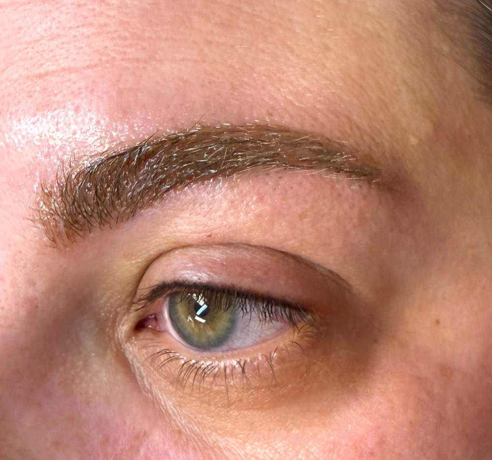 Lash Enhancement