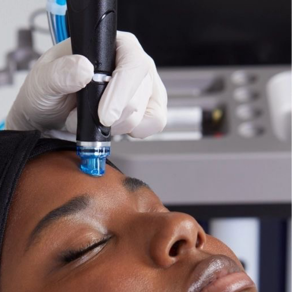 Hydro Glow Facial at Étoile Briyan in Malden, MA