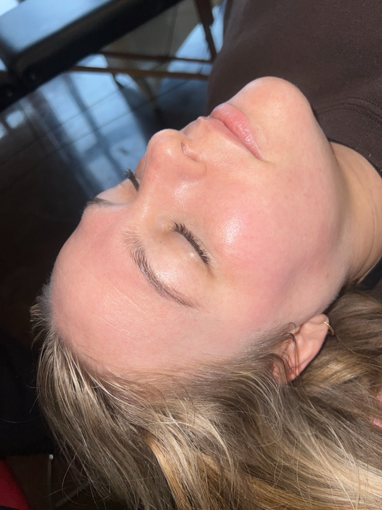 Dermaplaning Facial