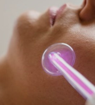 Acne Edit Facial