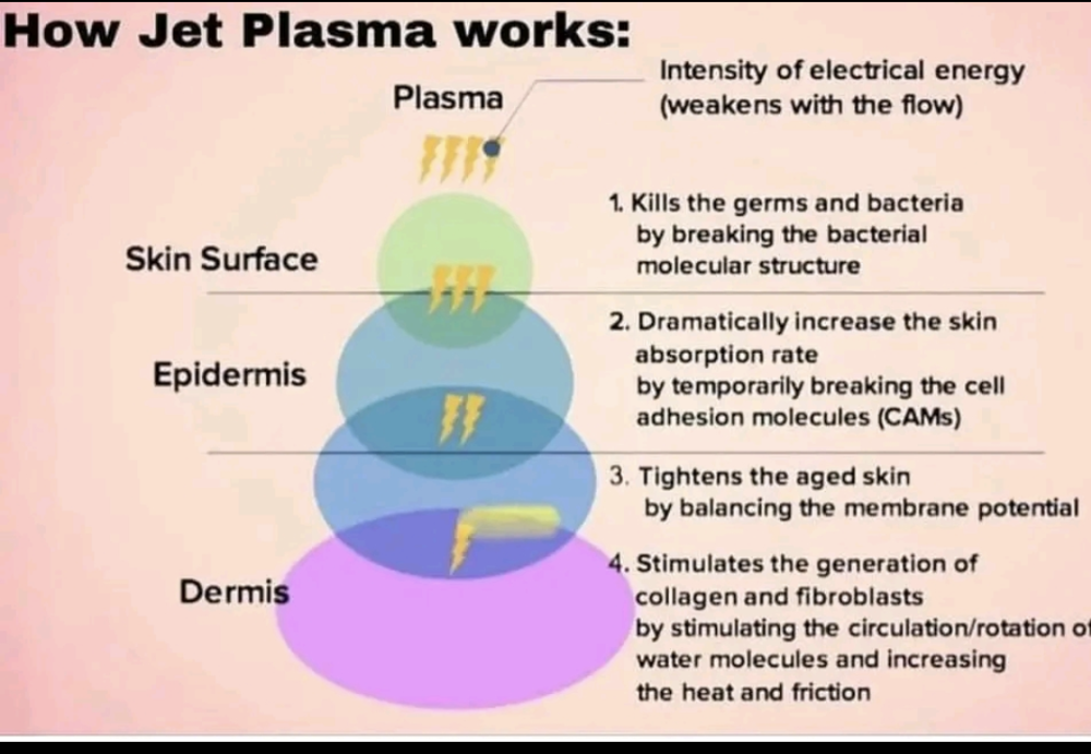 Jet Plasma Consult