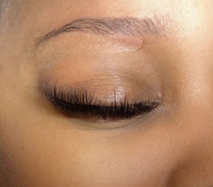 Hybrid Mini Fill
