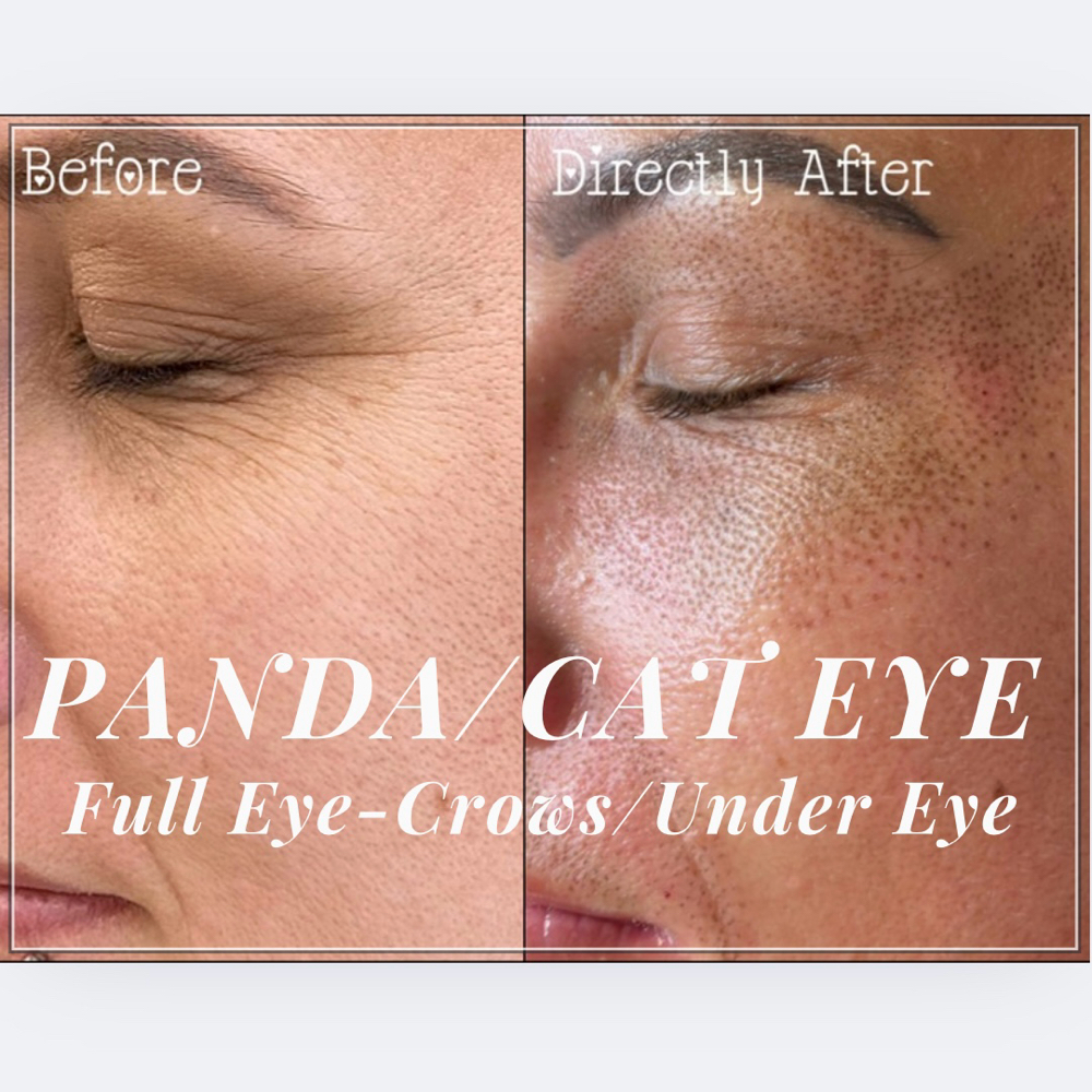 Full Eye-Panda Eye/Cat Eye Lift