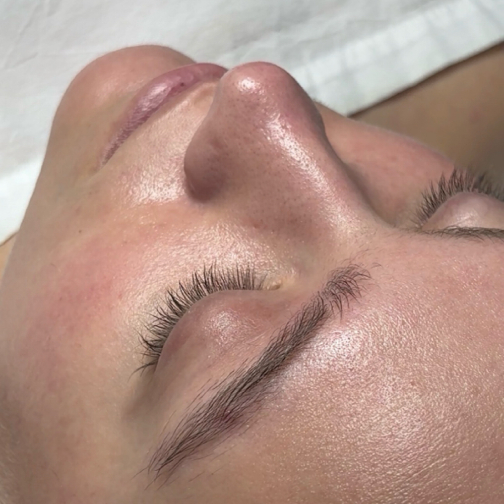 Enzyme Facial at Lashed by Nat in Middletown, NY