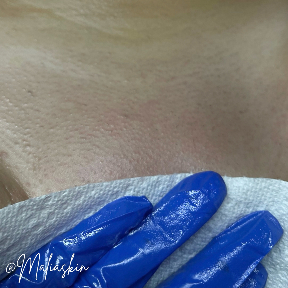 FEMALE BRAZILIAN WAX