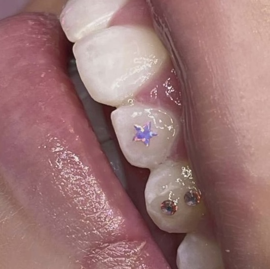 Single Opal Shape
