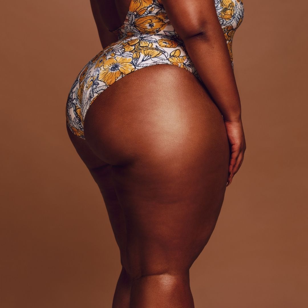 Cellulite Reduction Therapy
