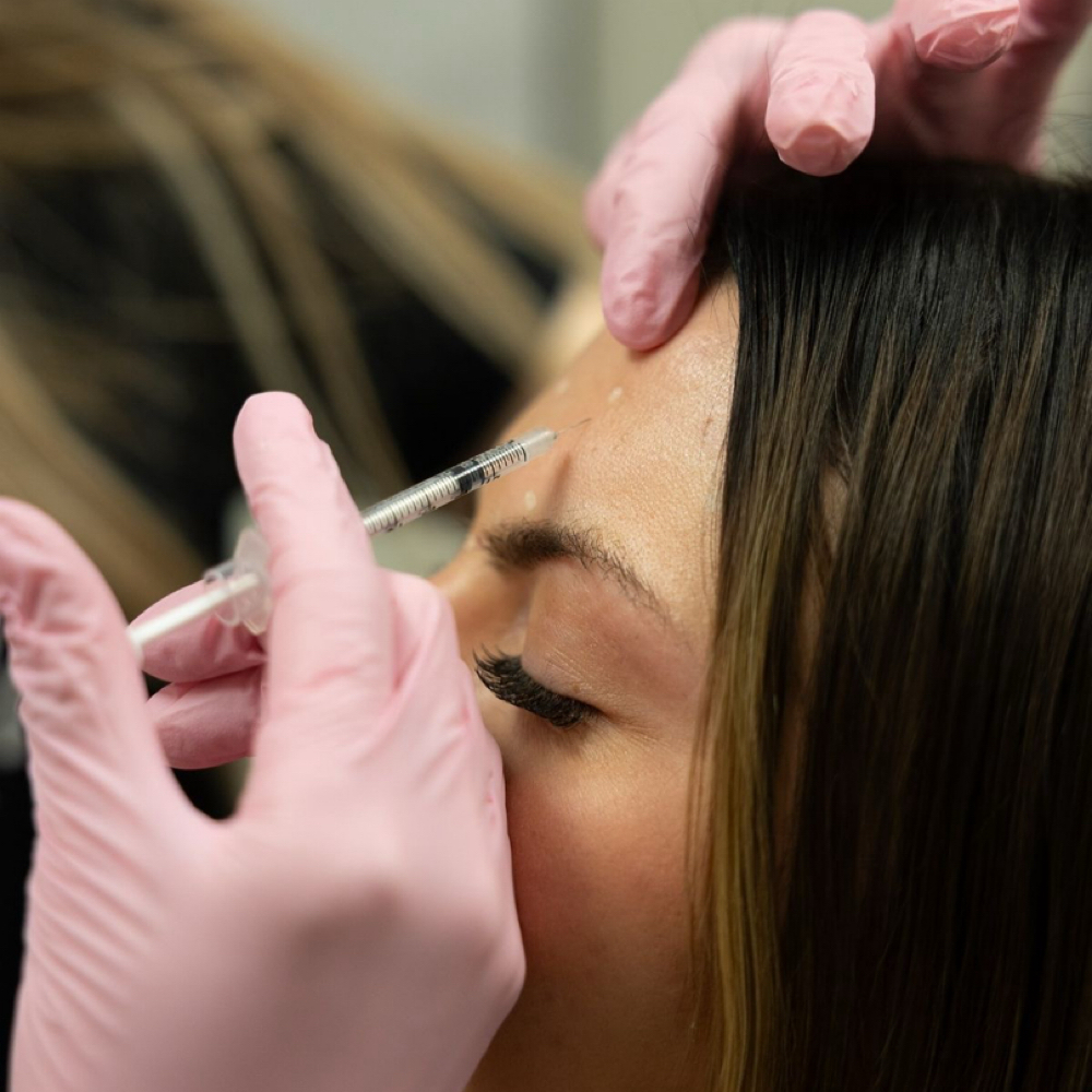 May Special | Full Upper Face at Bare Aesthetics ATX in Austin, TX