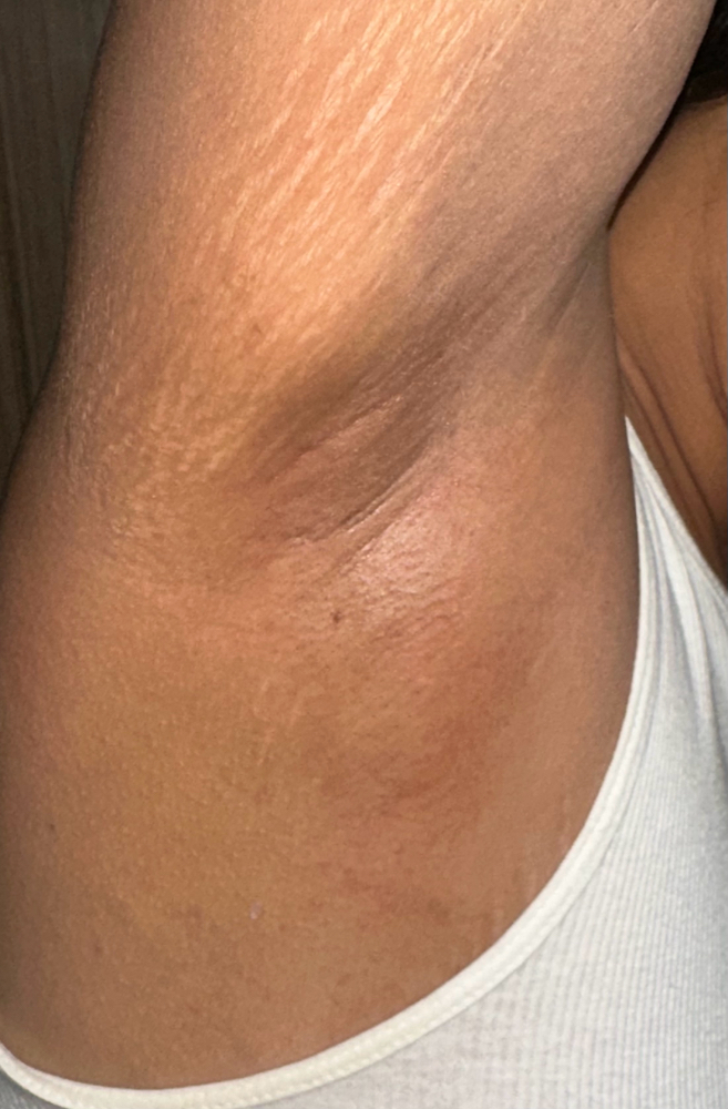Armpit Waxing