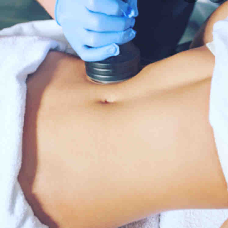Body Contouring(sculpting)