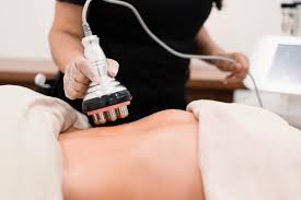 Body Contouring